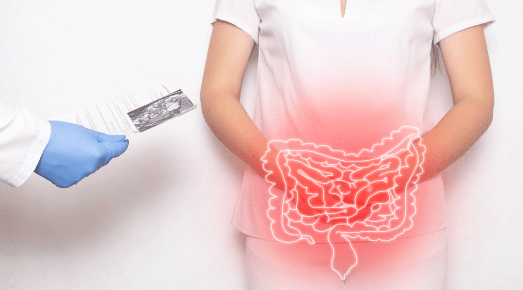 Colorectal cancer, commonly known as bowel cancer, originates from the inner lining of the bowel and often develops from polyps, which can turn cancerous if left undetected. Depending on its origin, it may be labeled as colon or rectal cancer. In 2023, over 15,300 individuals received a bowel cancer diagnosis, with an average age of 69 at diagnosis. It ranks as the fourth most prevalent cancer in Australia, and roughly one in 20 individuals will face a diagnosis by age 85.
