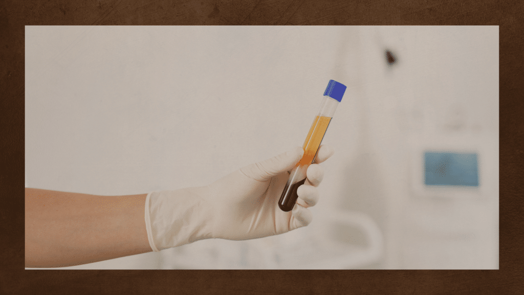 Platelet Rich Plasma
