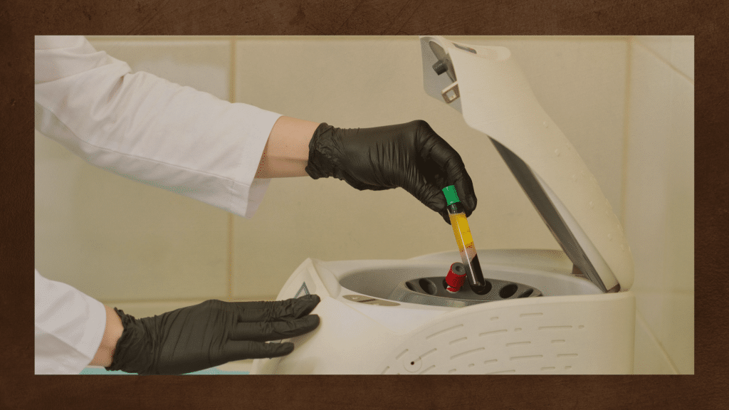 Platelet Rich Plasma
