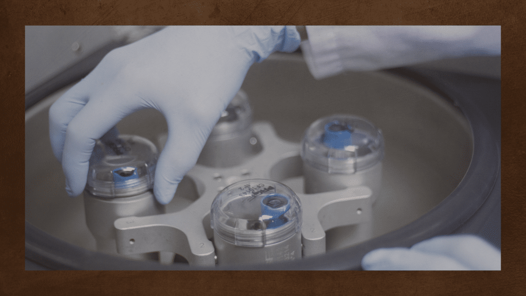 Platelet Rich Plasma