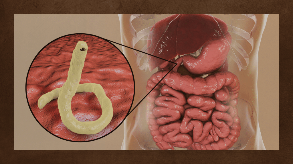 Duodenitis