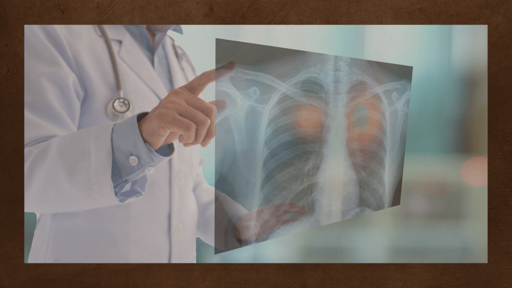 lung cancer