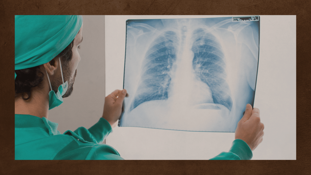 lung cancer