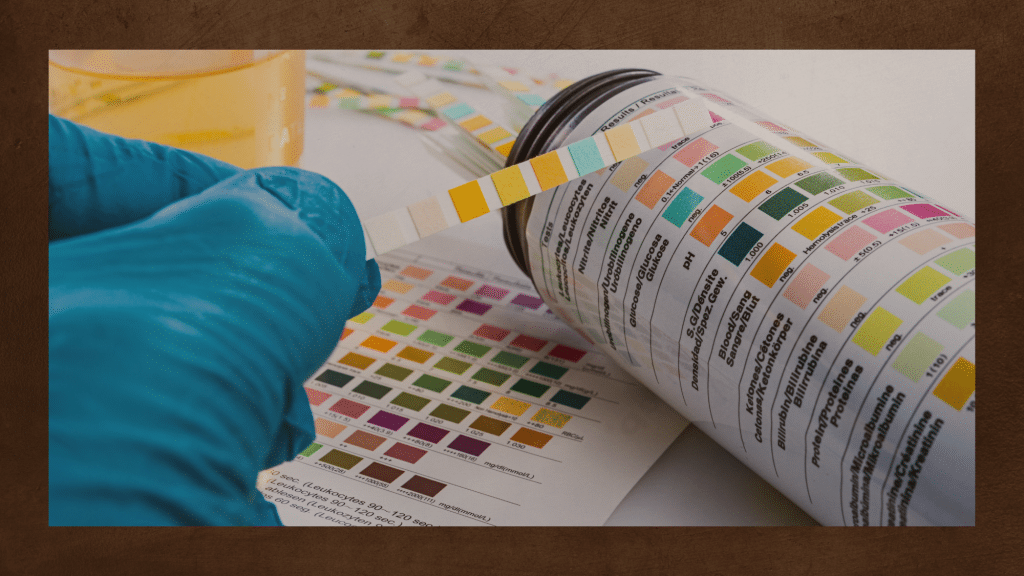Colour of urine