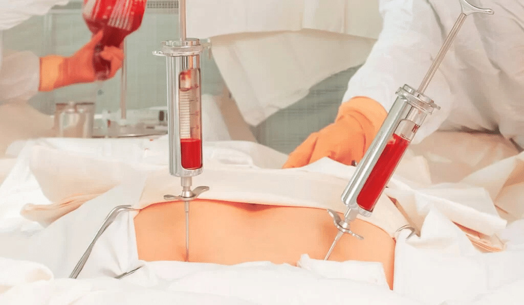 Best countries for bone marrow surgery abroad