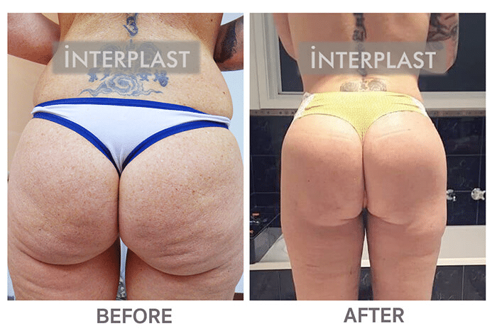 Before & After