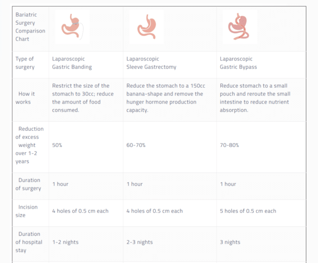 Bariatric Surgery Comparison Chart