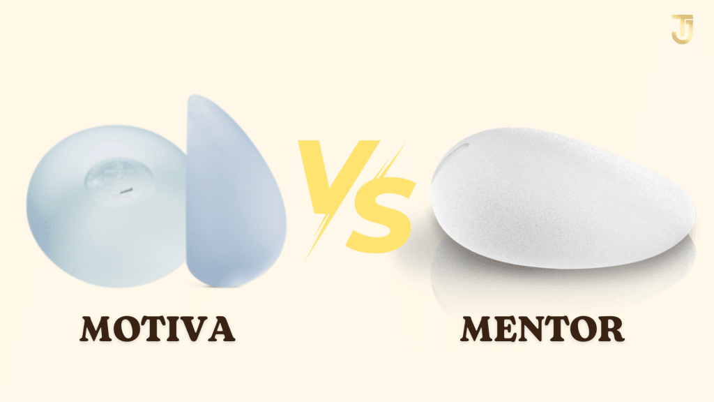 Mentor vs Motiva